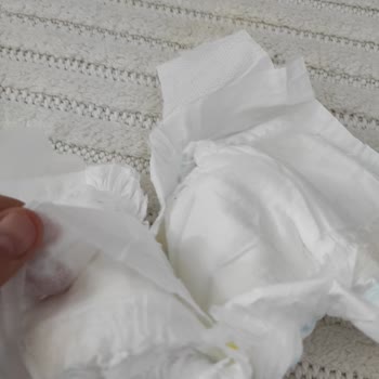 Molfix Bebek Bezi Kalitesizliği!