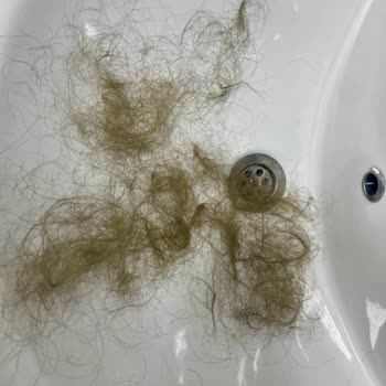 Zen Kuaför Salonları (Eskişehir) Saçlarımı Yaktılar Ve Sıfıra Vurdurma Zorunda Kaldım!