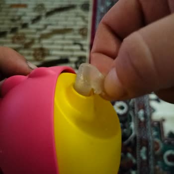 Philips Avent Kalitesizliği Ve Yedek Parça Sıkıntısı