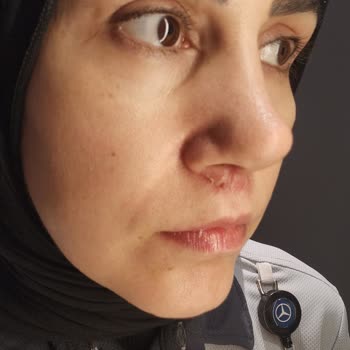 Ataköy Hastanesi Ameliyat Sonrası Hayal Kırıklığı
