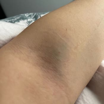 Okan Üniversitesi Hastanesi Bu Kadar Da Olmaz