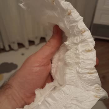 5 Numara Baby Turco Bez Ve Geçmeyen Pişik