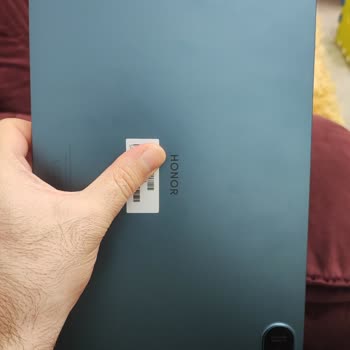 Honor Pad 8 - 2 Aylık Tablet Donuyor