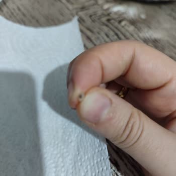 Hünkar Bakliyat Pirinçten Böcek Çıkıyor!