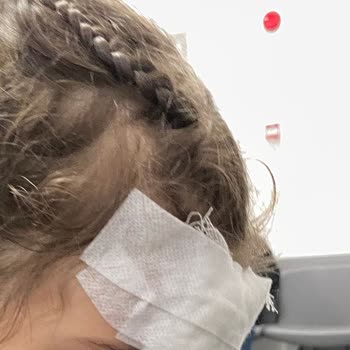 Servet Ünsal Tıp Merkezi 3500₺ Lik Eziyet