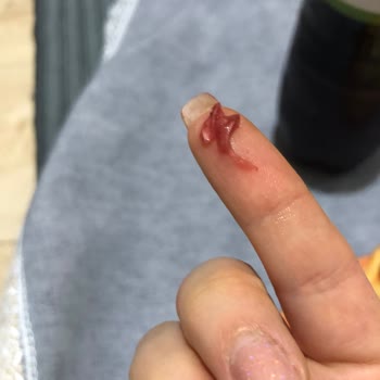 Cappy Meyve Suyunun İçinden Çıkan Yabancı Madde