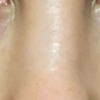 Estee Lauder Eye Gel-creme Egzama Yaptı