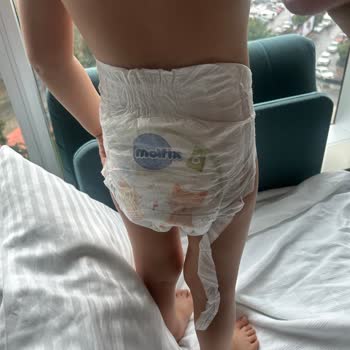 Molfix Bebek Bezi Sızdırıyor