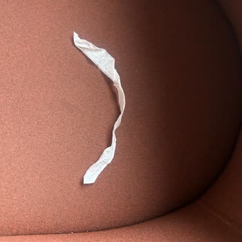 Molfix Bebek Bezi Sızdırıyor