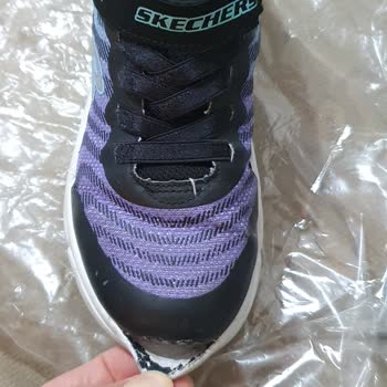 Skechers 4. Ay Sonunda Yırtılma Ve Müşteriyi Haksız Durumda Bırakması