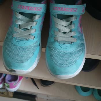 Skechers 4. Ay Sonunda Yırtılma Ve Müşteriyi Haksız Durumda Bırakması