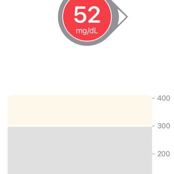 Dexcom Kritik Uyarısı Sürekli Geliyor Ölçmüyor