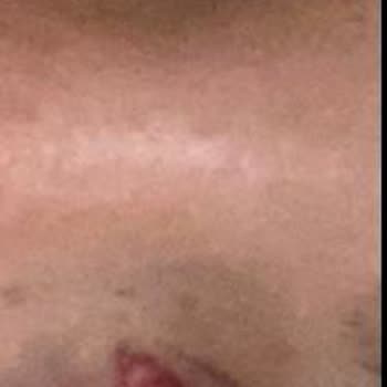 Eyüp Protez Tırnak Kirpik Uygulama Hizmetlerinde Yaşanan Sorunlar