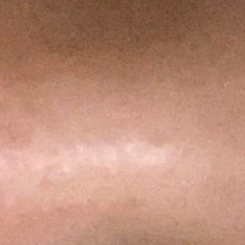 Eyüp Protez Tırnak Kirpik Uygulama Hizmetlerinde Yaşanan Sorunlar