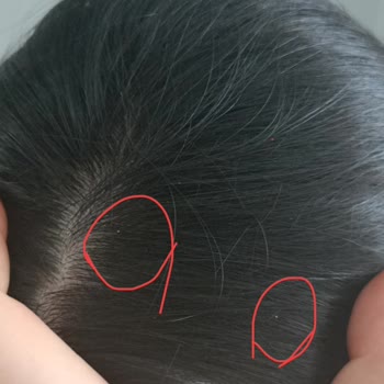 Bioxin Den Şikayetçiyim