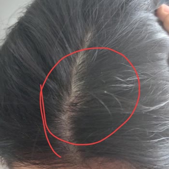 Bioxin Den Şikayetçiyim