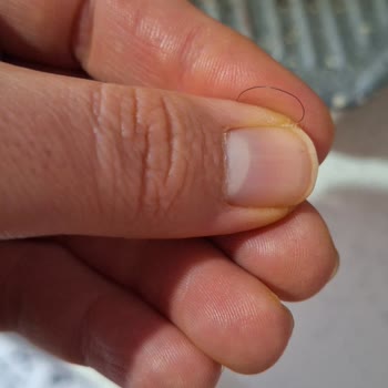 Köfteci Yusuf Köfte'den Kıl Çıktı