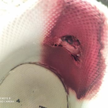 Nike'tan Aldığım Ayakkabı Ayağı Mahvetti