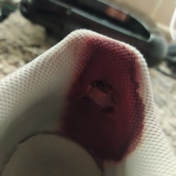 Nike'tan Aldığım Ayakkabı Ayağı Mahvetti