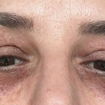 Doku Tıp Merkezi Doku Medikalde Yasanan Mağduriyet