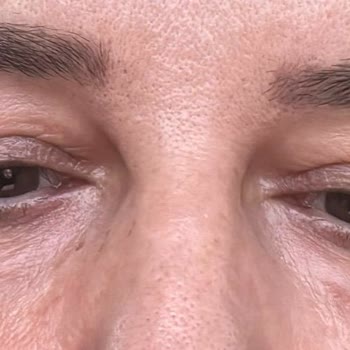 Doku Tıp Merkezi Doku Medikalde Yasanan Mağduriyet