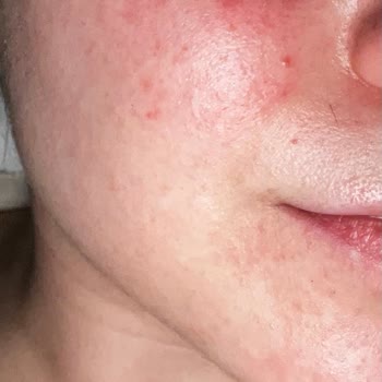 Cildim İçin Yanlış Tercih: Darphin Hayal Kırıklığı