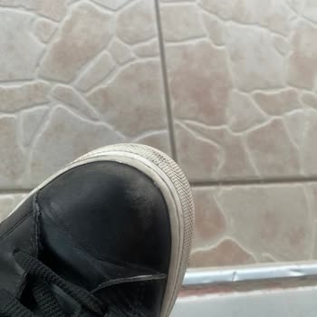 Deery Ayakkabımda Açılma