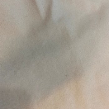 Dry Center Kuru Temizleme Yeni Trençkotumda Yırtık Ve Tüylenme!