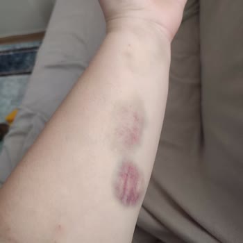 Medical Park Hastanesi Göztepe Tavrı