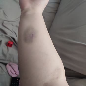 Medical Park Hastanesi Göztepe Tavrı