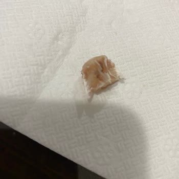 BİM Markası Derya Ton Balığının İçinden Çıkan Sert Kemik Parçası