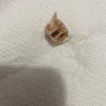 BİM Markası Derya Ton Balığının İçinden Çıkan Sert Kemik Parçası