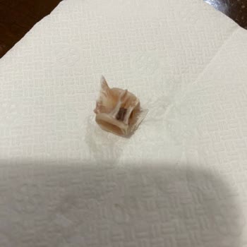 BİM Markası Derya Ton Balığının İçinden Çıkan Sert Kemik Parçası