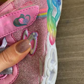 Skechers Ayıplı Ayakkabıyı İade Ve Değişim Yapmıyor