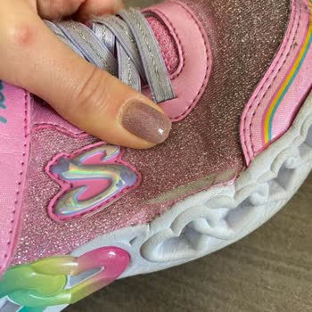 Skechers Ayıplı Ayakkabıyı İade Ve Değişim Yapmıyor
