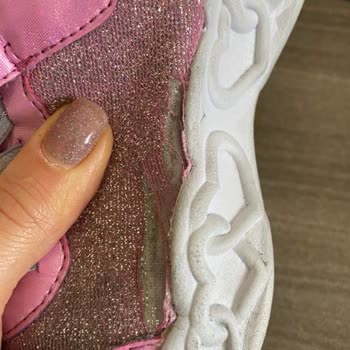 Skechers Ayıplı Ayakkabıyı İade Ve Değişim Yapmıyor