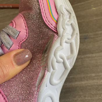 Skechers Ayıplı Ayakkabıyı İade Ve Değişim Yapmıyor