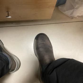 Skechers Ayakkabı Memnuniyetsizliği Görsel Olarak Paylaştım