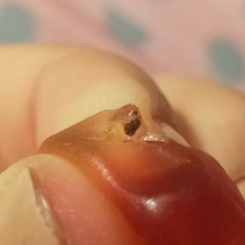 Haribo'dan Çıkan Şey Ve İlgisizlikleri