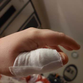 Prof. Dr. Feriha Öz Acil Durum Hastanesi Acil Serviste Dikiş Malzemesi Eksikliği