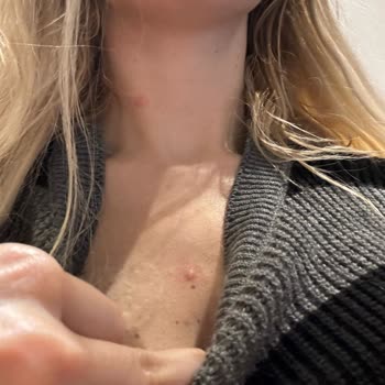 Solgar Calcium Magnesium Plus Zinc Alerji Şikayeti