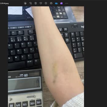 Özel Cihangir Hastanesi Hastane Çalışanlar Saatler Vs