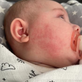 Koçak Farma İlaç Vegaferon Acilen Kaldırılsın