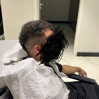 Need Clinic Başarısız Saç Ekimi