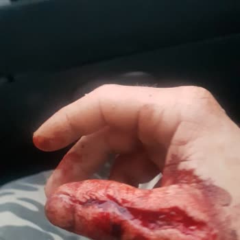 Kumluca Devlet Hastanesi İlgisiz Ve Sorumsuz