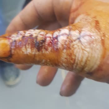 Kumluca Devlet Hastanesi İlgisiz Ve Sorumsuz