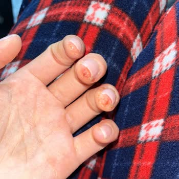 Hadise İdi Protez Tırnak Kalıcı Oje Kalmıyor 😔