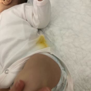 Prima Kalite Beklentilerini Karşılamayan Bebek Bezi