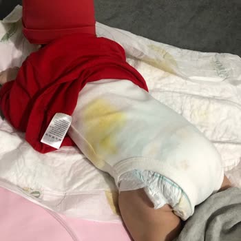 Prima Kalite Beklentilerini Karşılamayan Bebek Bezi