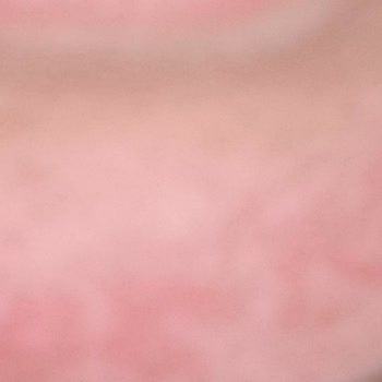 Four Win Markasının Yüz Temizleme Ve Toniği Yüzümü Yaktı